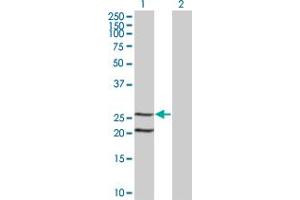 Western Blot analysis of IL6 expression in transfected 293T cell line by IL6 monoclonal antibody (M07), clone 1G8. (IL-6 antibody  (AA 29-212))