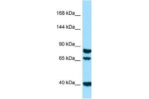 Western Blotting (WB) image for anti-Signal Peptide, CUB Domain, EGF-Like 1 (SCUBE1) (N-Term) antibody (ABIN2790193) (SCUBE1 antibody  (N-Term))