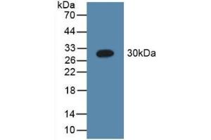 Detection of Recombinant C1qA, Human using Polyclonal Antibody to Complement Component 1, Q Subcomponent A (C1qA) (C1QA antibody  (AA 28-245))