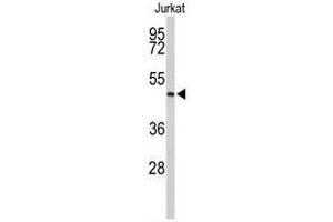 Western blot analysis of ACR Antibody (C-term) in Jurkat cell line lysates (35 µg/lane). (Acrosin antibody  (C-Term))