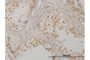 Immunoperoxidase of monoclonal antibody to OXSR1 on formalin-fixed paraffin-embedded human testis. (OXSR1 antibody  (AA 351-450))