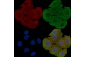 ABIN6260813 and ABIN6277925 staining Hela cells(30 min of UV treatment) by IF/ICC.
