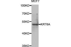 Western blot analysis of extracts of MCF-7 cells, using KRT6A antibody (ABIN5974635) at 1/1000 dilution. (KRT6A antibody)