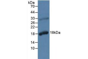 Figure. (Kallikrein 2 antibody  (AA 19-261))