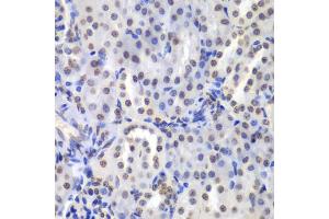 Immunohistochemistry of paraffin-embedded mouse kidney using PRKCB antibody (ABIN6290747) at dilution of 1:200 (40x lens).