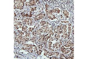 IHC analysis of PTBP1 using anti-PTBP1 antibody (ABIN7599451). (PTBP1 antibody  (AA 1-504))