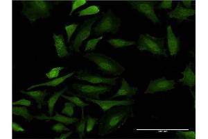 Immunofluorescence of monoclonal antibody to GAGE5 on HeLa cell. (G Antigen 5 antibody  (AA 28-117))