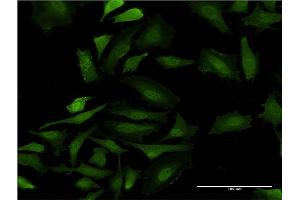 Immunofluorescence of monoclonal antibody to GAGE5 on HeLa cell.