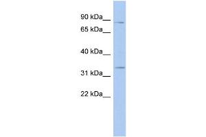 WB Suggested Anti-STX19 Antibody Titration: 0. (Syntaxin 19 antibody  (N-Term))