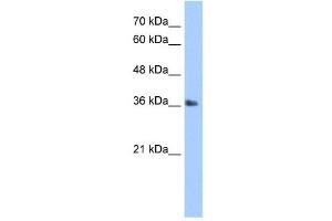 TIPIN antibody (20R-1275) used at 0. (TIPIN antibody  (N-Term))