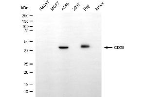 Western blotting analysis using CD38 antibody (ABIN7797967).