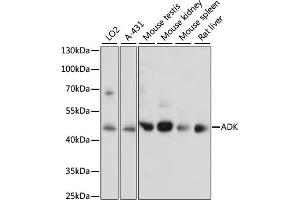 Western blot analysis of extracts of various cell lines, using ADK antibody  at 1:1000 dilution. (ADK antibody  (AA 200-345))