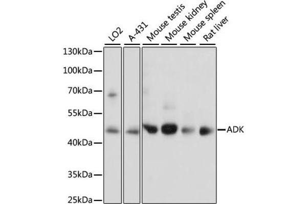 ADK 抗体  (AA 200-345)