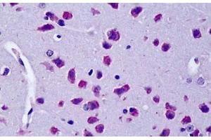 ABIN190823 (5µg/ml) staining of paraffin embedded Mouse Brain. (CYLD antibody  (Internal Region))