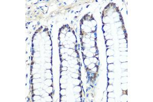 Immunohistochemistry of paraffin-embedded human colon using Chk1 Rabbit mAb (ABIN1680915, ABIN7101643, ABIN7101644 and ABIN7101645) at dilution of 1:100 (40x lens). (CHEK1 antibody)