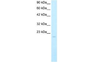 WB Suggested Anti-SAntibody Titration:  5. (SP140 antibody  (N-Term))