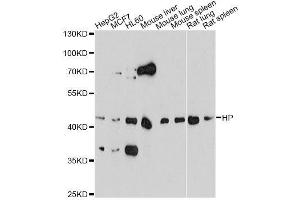 Western blot analysis of extracts of various cell lines, using HP antibody. (Haptoglobin antibody)