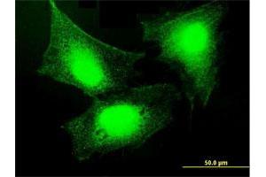 Immunofluorescence of purified MaxPab antibody to GBP5 on HeLa cell. (GBP5 antibody  (AA 1-586))