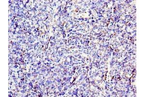 Immunohistochemistry of paraffin-embedded human thymus tissue using ABIN7171339 at dilution of 1:100 (CD6 antibody  (AA 424-668))