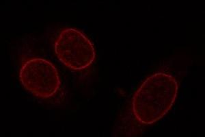 Image no. 2 for anti-Nucleoporin 153kDa (NUP153) (AA 1456-1475) antibody (ABIN7048098) (NUP153 antibody  (AA 1456-1475))