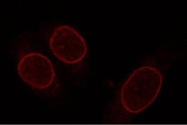 NUP153 antibody  (AA 1456-1475)
