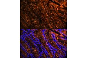 Immunofluorescence analysis of mouse colon using Galectin 4/LG Polyclonal Antibody (ABIN7267339) at dilution of 1:100 (40x lens). (GAL4 antibody  (AA 1-100))