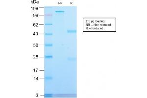 SDS-PAGE Analysis Purified CD71 Rabbit Recombinant Monoclonal Antibody (TFRC/2898R). (Recombinant Transferrin Receptor antibody  (Extracellular Domain))