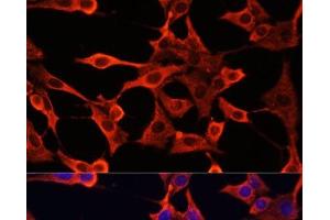 Immunofluorescence analysis of NIH/3T3 cells using TYMS Polyclonal Antibody at dilution of 1:100. (TYMS antibody)
