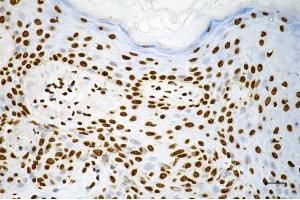 Immunohistochemistry was performed on paraffin-embedded human skin tissue using macroH2A. (Recombinant Histone, H2A1, Macro antibody)