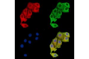 ABIN7096113 and ABIN7100175 staining Hela cells by IF/ICC. (WDR41 antibody)