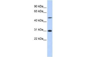 Western Blotting (WB) image for anti-Inhibitor of Growth Family, Member 3 (ING3) antibody (ABIN2458018) (ING3 antibody)