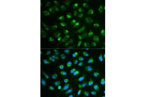 Immunofluorescence analysis of MCF7 cell using IL7 antibody. (IL-7 antibody)
