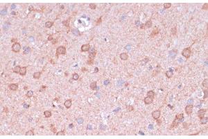 Immunohistochemistry of paraffin-embedded Rat brain using TIMM8B Polyclonal Antibody at dilution of 1:100 (40x lens). (TIMM8B antibody)