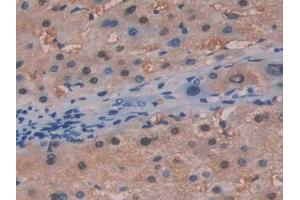 DAB staining on IHC-P; Samples: Human Liver Tissue (FAH antibody  (AA 189-419))