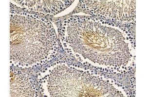 ABIN7094985 and ABIN7099041 at 1/100 staining rat testis tissue by IHC-P. (MLXIPL antibody)