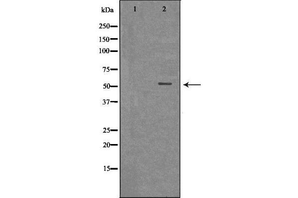 MLKL antibody  (Internal Region)