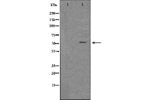 Western blot analysis of extracts of THP-1 , using MLKL antibody. (MLKL antibody  (Internal Region))