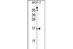 ZN Antibody (Center) (ABIN654974 and ABIN2844614) western blot analysis in MCF-7 cell line lysates (35 μg/lane). (ZNF720 antibody  (AA 34-62))