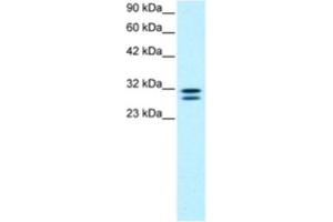 Western Blotting (WB) image for anti-HIV-1 Tat Interactive Protein 2, 30kDa (HTATIP2) antibody (ABIN2460567) (HIV-1 Tat Interactive Protein 2, 30kDa (HTATIP2) antibody)
