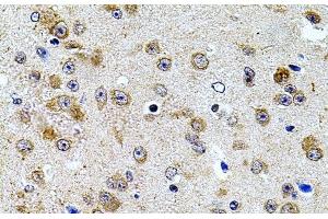 Immunohistochemistry of paraffin-embedded Mouse brain using CAST Polyclonal Antibody at dilution of 1:100 (40x lens). (Calpastatin antibody)
