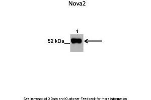 Lanes:   1. (NOVA2 antibody  (N-Term))
