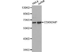 Western blot analysis of extracts of various cell lines, using CDKN2AIP antibody. (CDKN2AIP antibody  (AA 1-220))