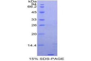 SDS-PAGE analysis of Human Apolipoprotein C1 Protein.