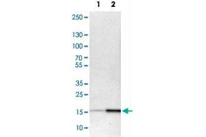 Western Blot analysis of Lane 1: NIH-3T3 cell lysate (mouse embryonic fibroblast cells) and Lane 2: NBT-II cell lysate (Wistar rat bladder tumour cells) with ACP1 polyclonal antibody .