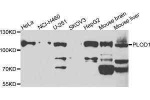 Western blot analysis of extracts of various cell lines, using PLOD1 antibody (ABIN5975225) at 1/1000 dilution.