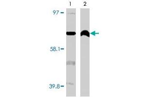 Western blot using CYP4F11 monoclonal antibody, clone F21 P6 F5  on normal (1) and cancerous (2) kidney cell lysates. (CYP4F11 antibody  (C-Term))