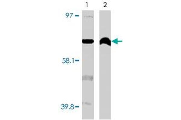 CYP4F11 anticorps  (C-Term)