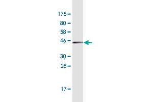 Western Blot detection against Immunogen (45. (JDP2 antibody  (AA 1-163))