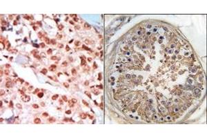 Image no. 1 for anti-Protein Kinase, AMP-Activated, gamma 1 Non-Catalytic Subunit (PRKAG1) (Middle Region) antibody (ABIN359117) (PRKAG1 antibody  (Middle Region))