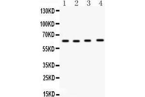 Western Blotting (WB) image for anti-Cell Division Cycle 6 Homolog (S. Cerevisiae) (CDC6) (AA 147-549) antibody (ABIN3043500) (CDC6 antibody  (AA 147-549))